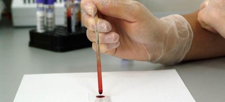 ¿Cómo interpretar un análisis de sangre?